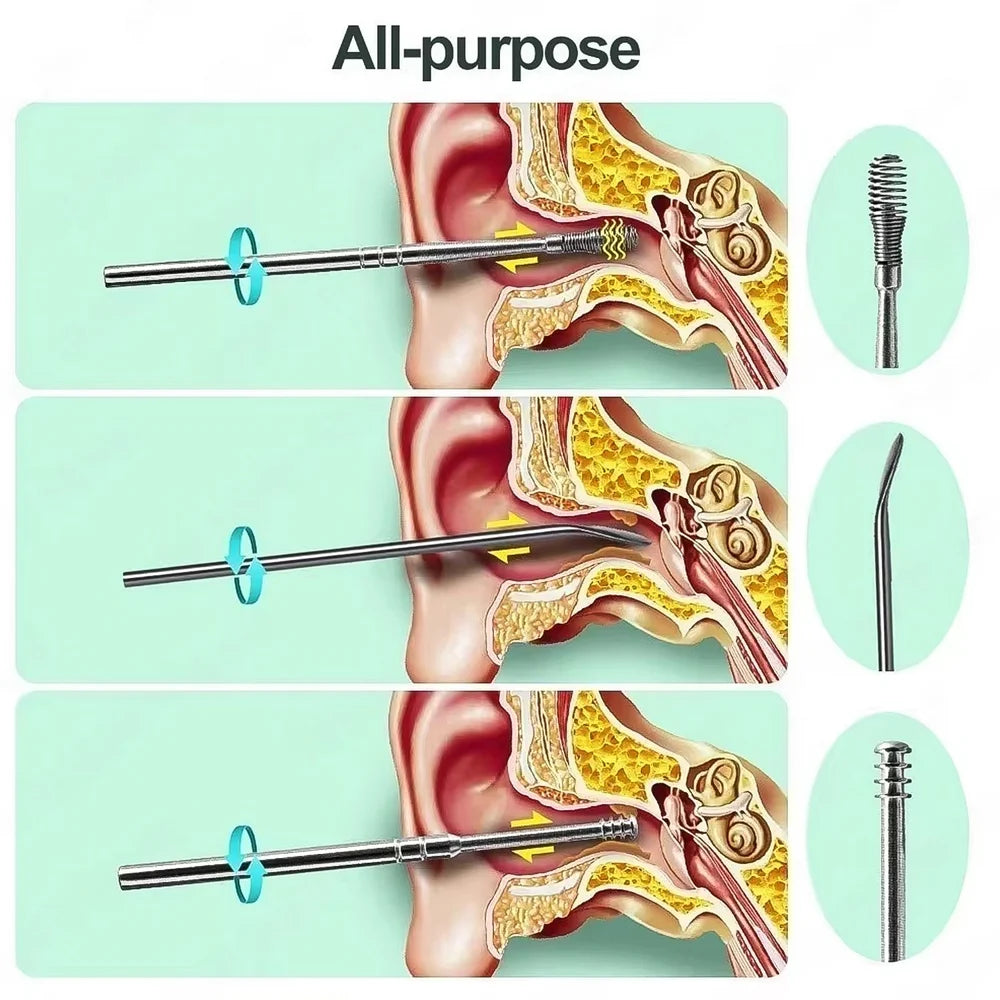 Portable Ear Wax Cleaner Kit