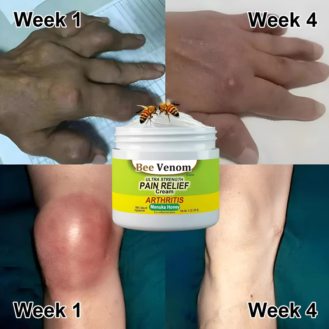 Bee Venom Joint and Bone Therapy Cream (100gm)