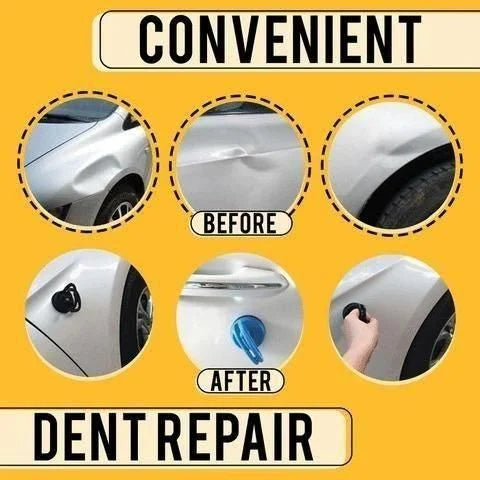 Professional Dent Removal Tool