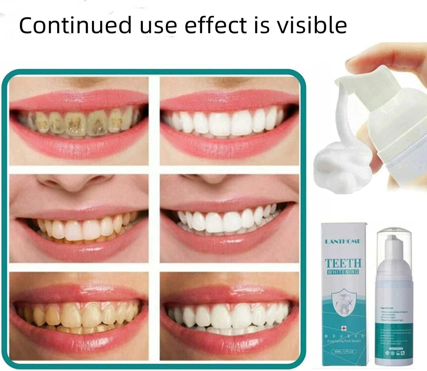 Teeth Whitening Foam 60ML