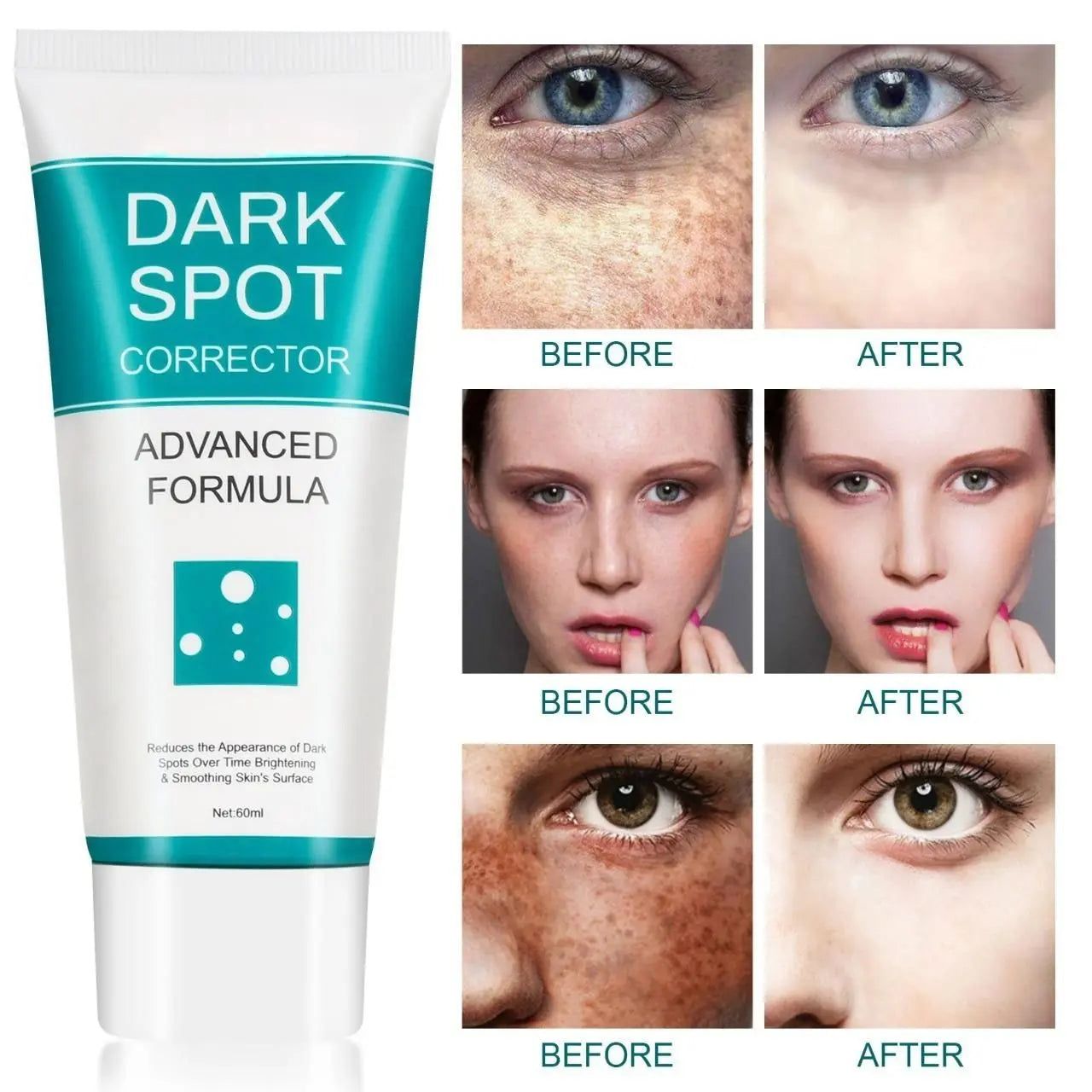 Dark Spot Correcting Cream