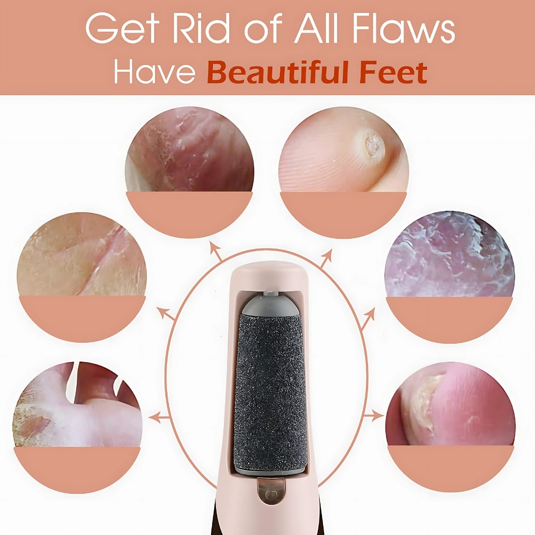 Electric Callus Remover Tool