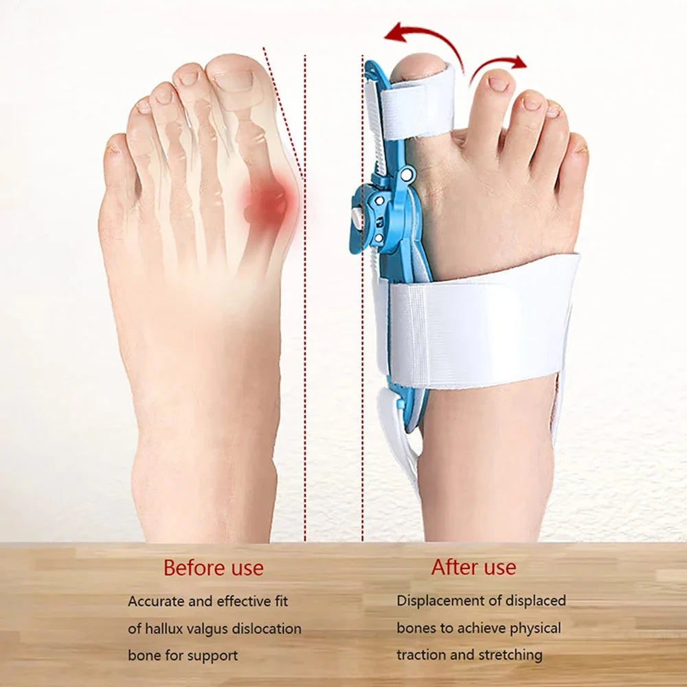 Adjustable Bunion Support Splint