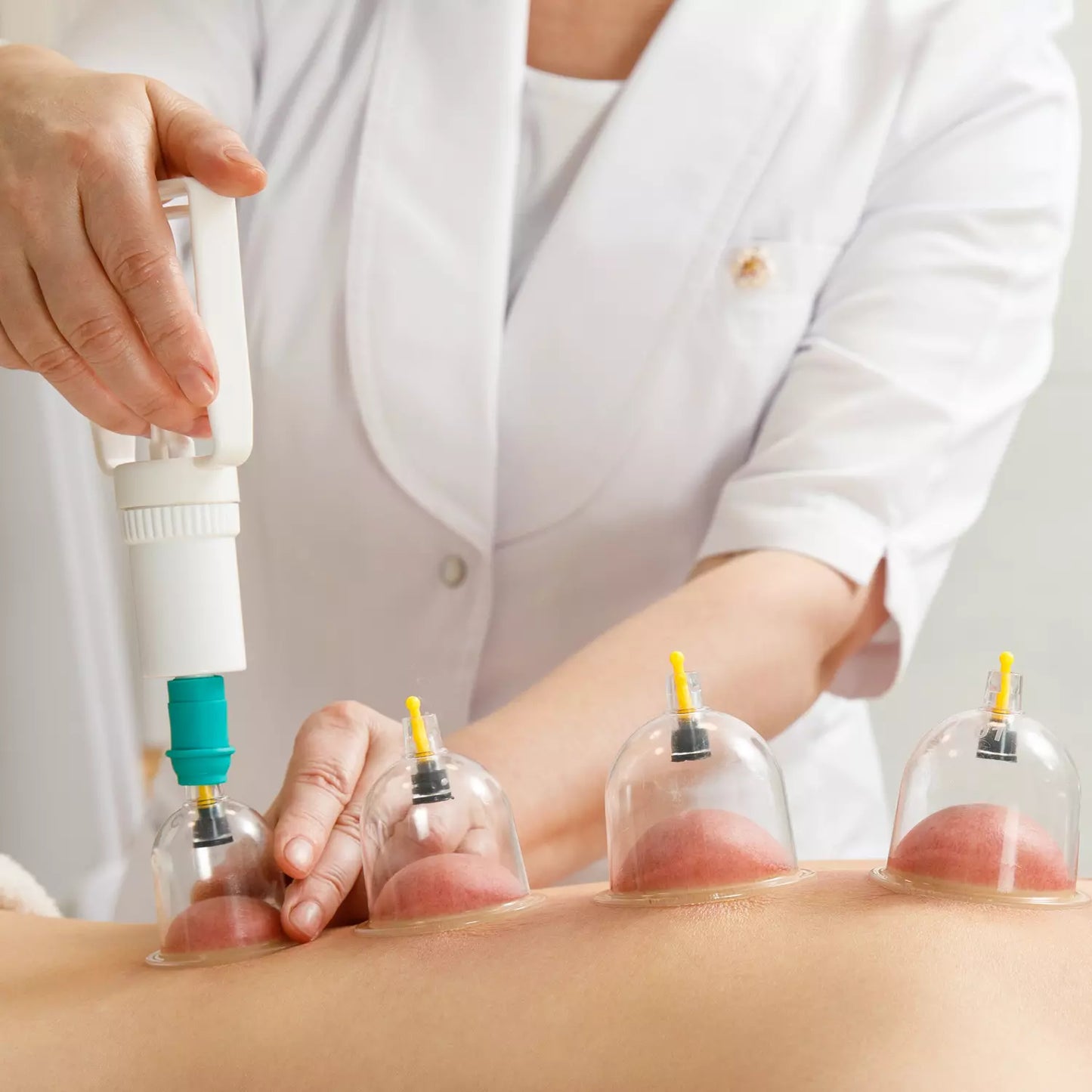 Professional Vacuum Cupping Set - Home Improvement