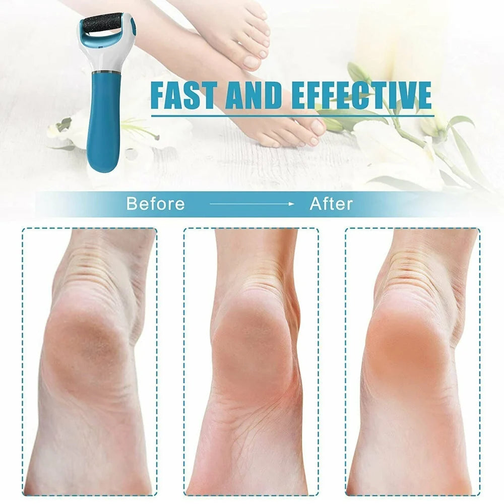 Electric Callus Remover for Feet