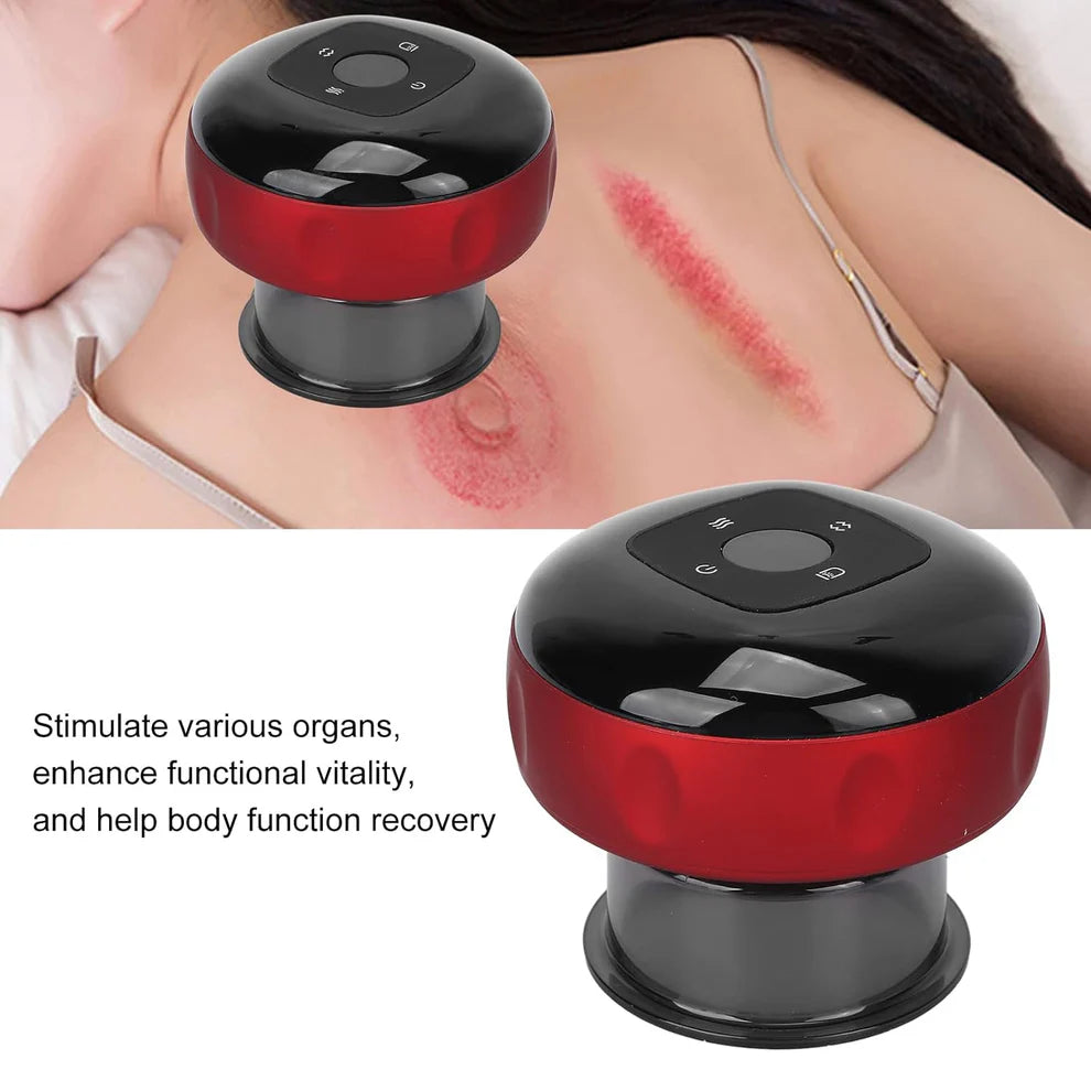 Electric Smart Cupping Massager