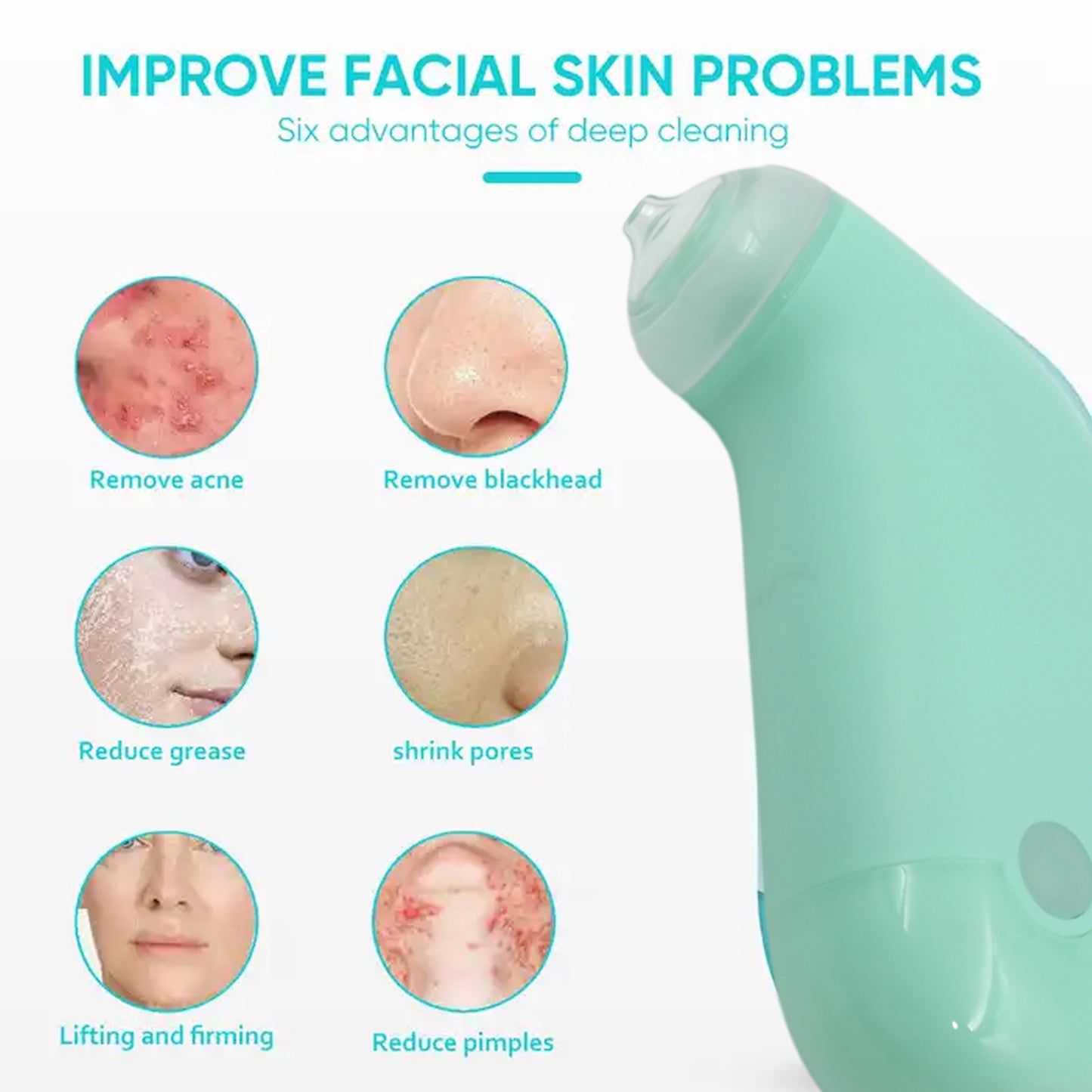 Vacuum Blackhead Remover