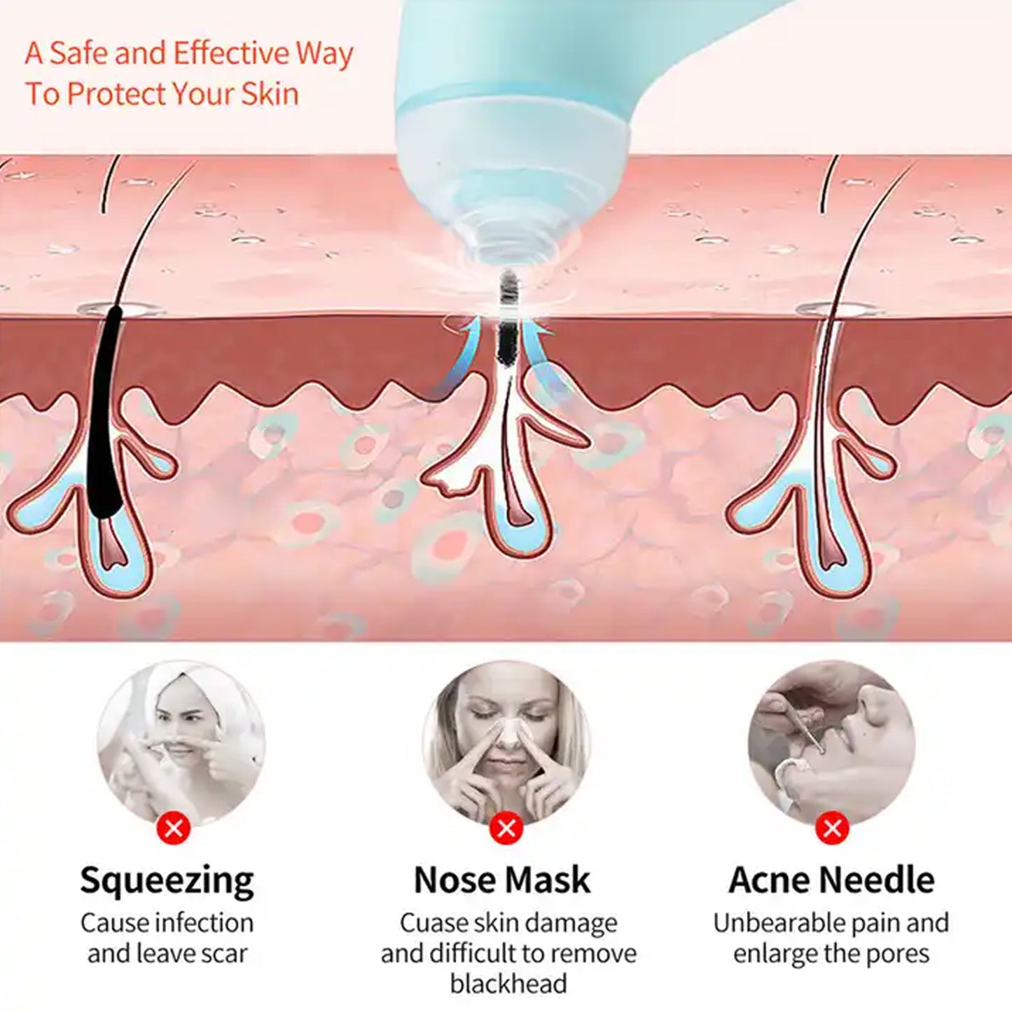Vacuum Blackhead Remover