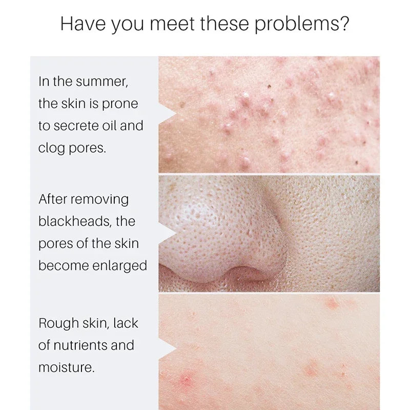 Pore Minimizing Face Serum