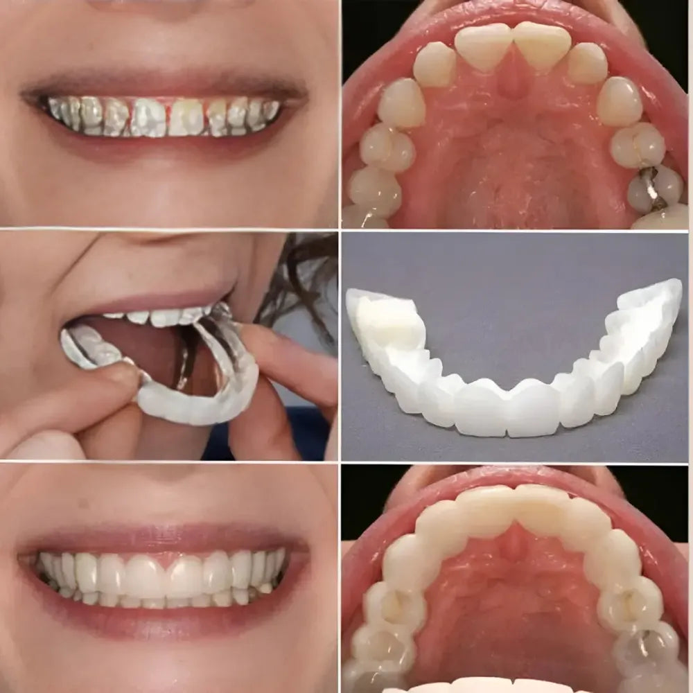 Advanced cosmetic teeth denture (buy 1 get free)