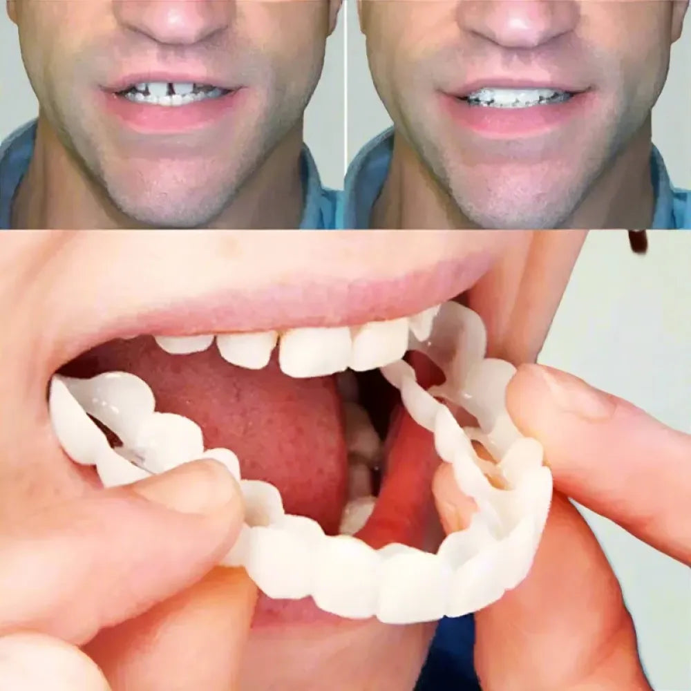 Advanced cosmetic teeth denture (buy 1 get free)