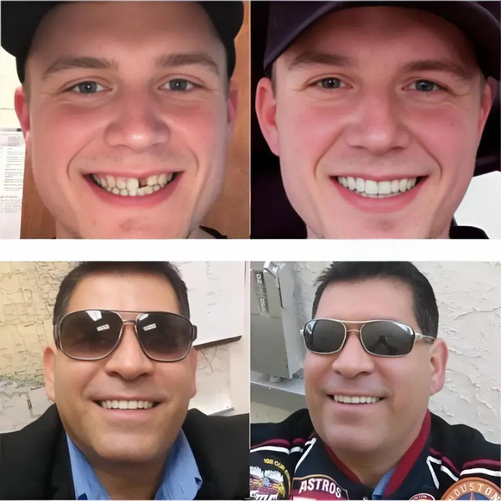 Advanced cosmetic teeth denture (buy 1 get free)