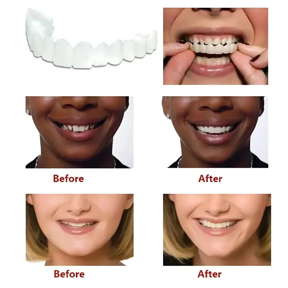 Advanced cosmetic teeth denture (buy 1 get free)