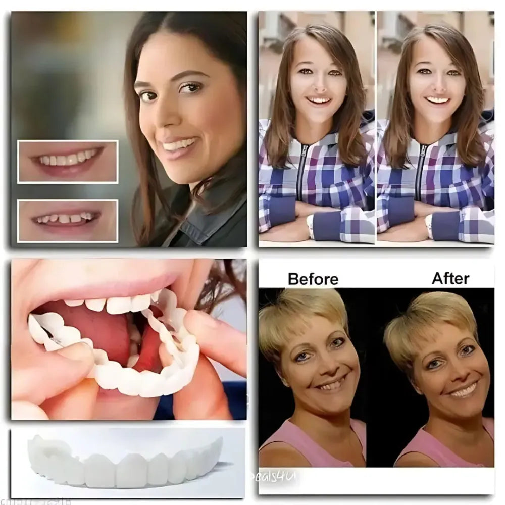 Advanced cosmetic teeth denture (buy 1 get free)