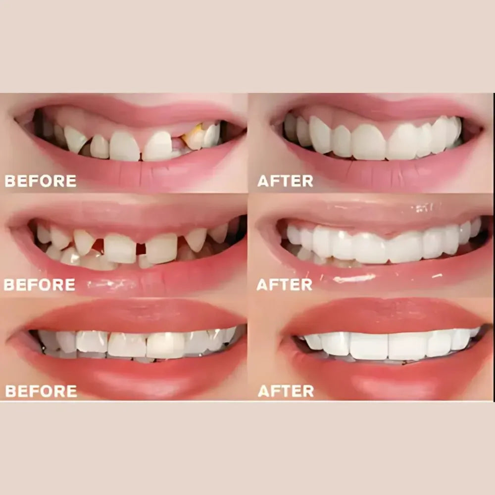 Advanced cosmetic teeth denture (buy 1 get free)