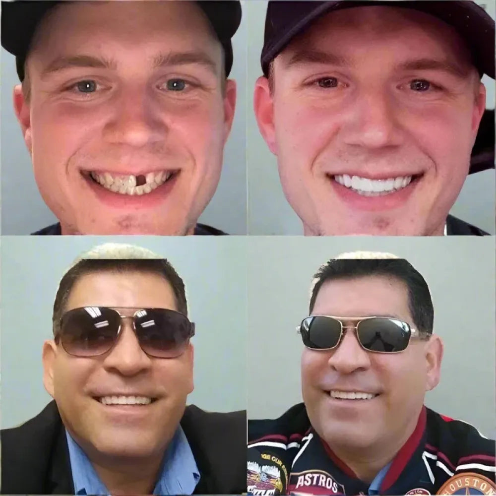 Advanced cosmetic teeth denture (buy 1 get free)