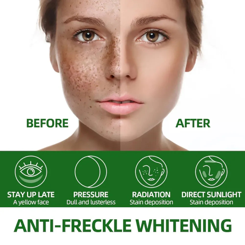 Anti-freckle green tea serum – 50ml (pack of 2)