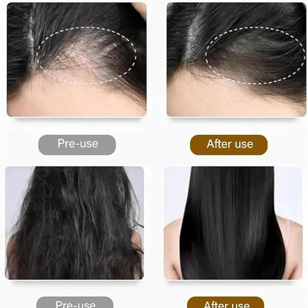 Anti hair loss shampoo 200ml (pack of 2)