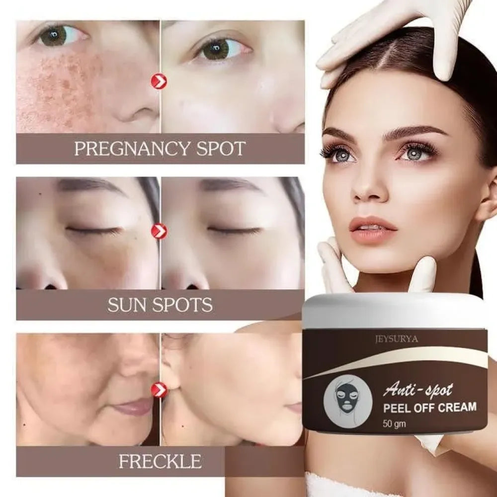 Anti-spot peel off cream