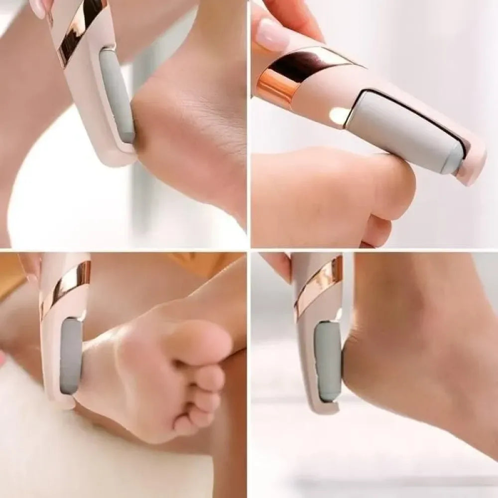 Cordless pedicure callus remover