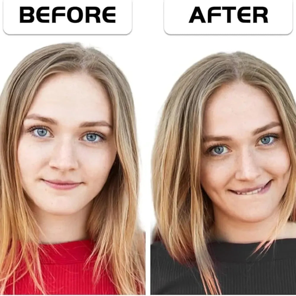 Dimples smile exerciser tool