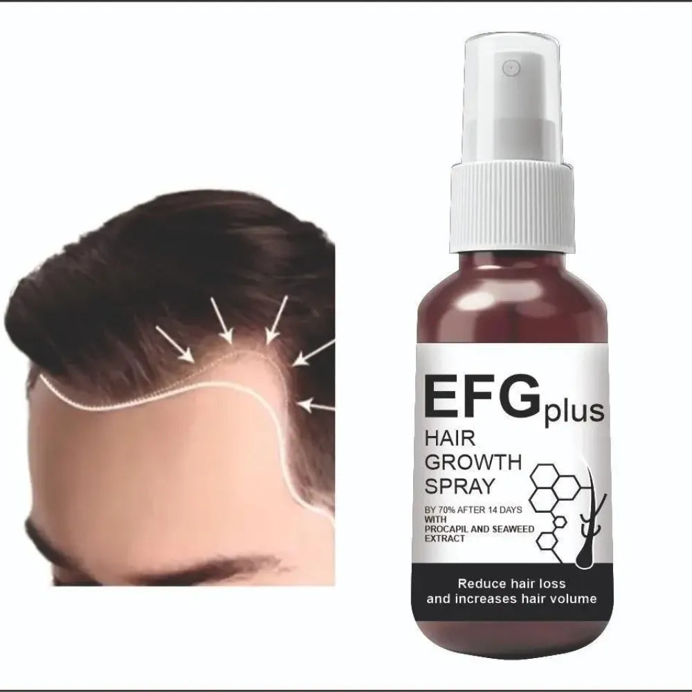 Efgplus hair growth spray – 50ml (pack of 2)