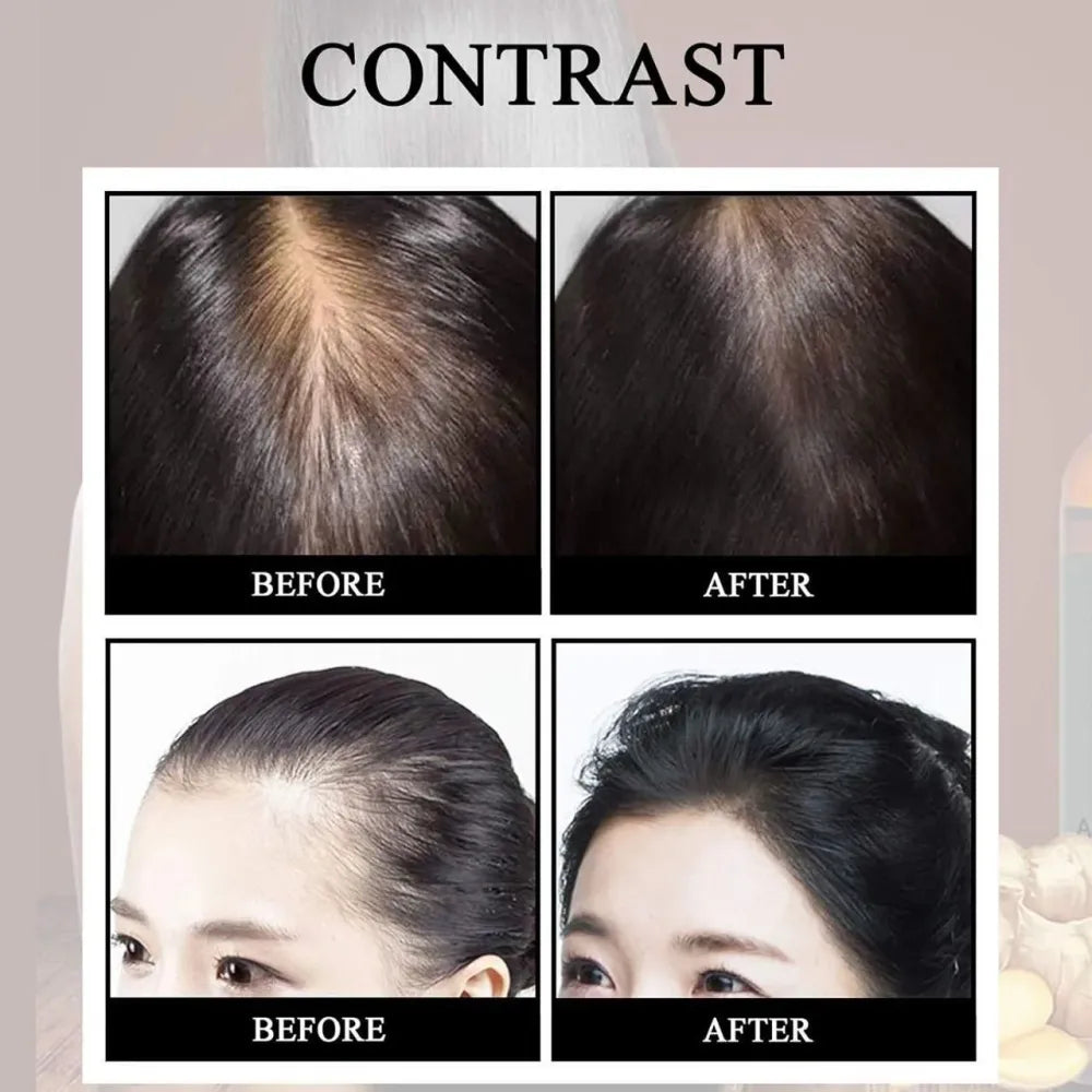 Ellohe hair growth fluid – 120ml