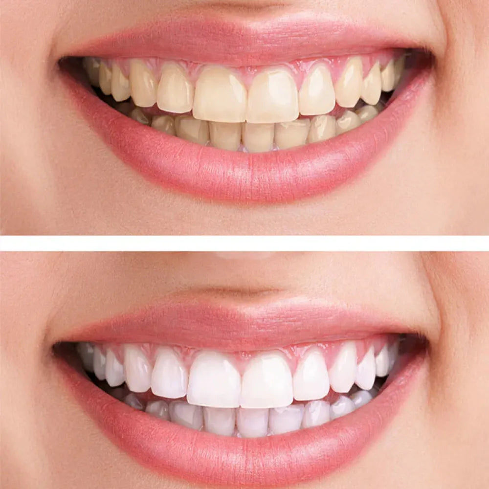 Fezora enamel repair toothpaste