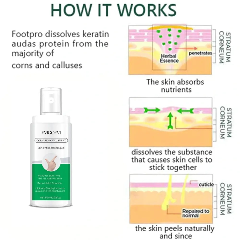 Fvigofvi corn removal spray – 60ml