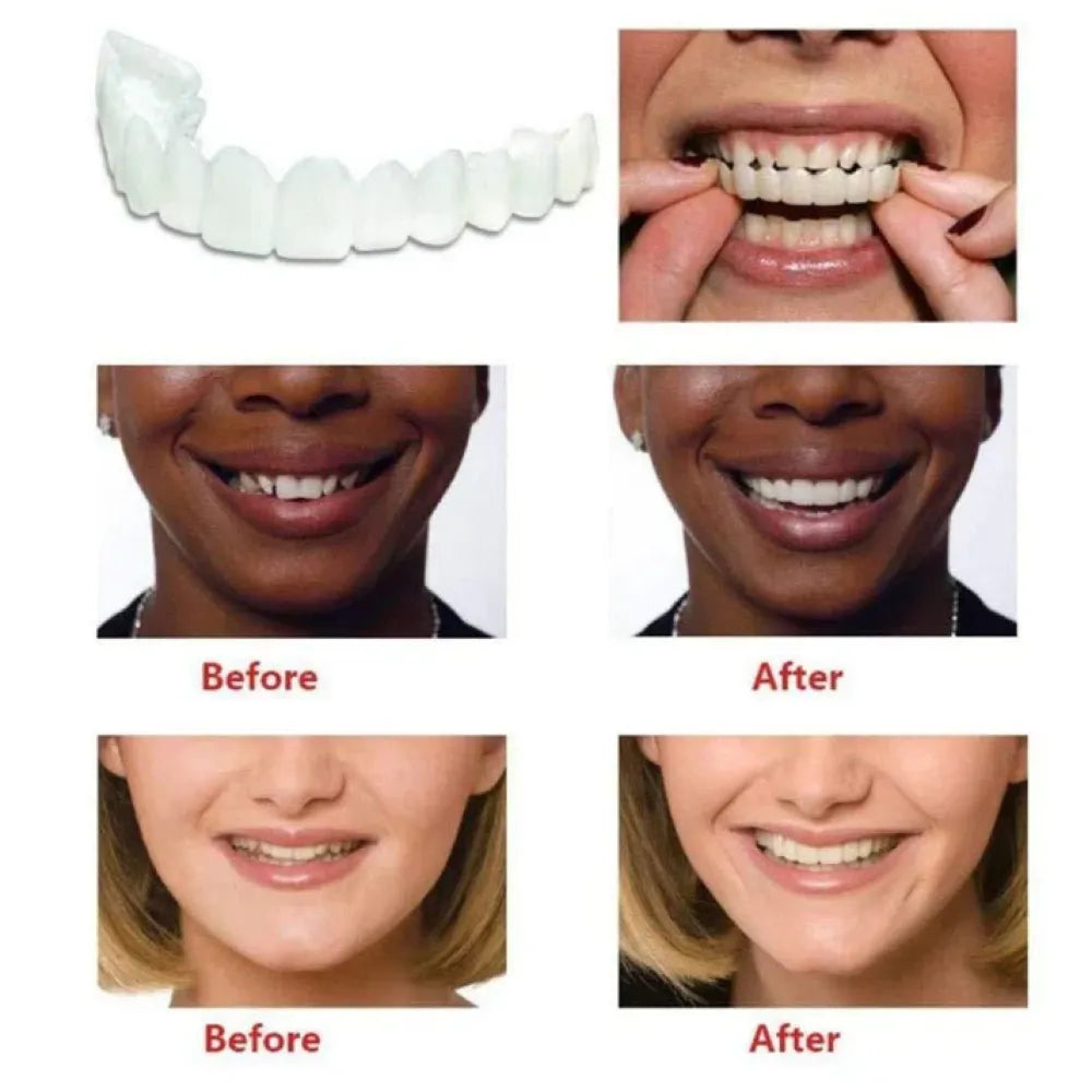 Instant smile cosmetic teeth