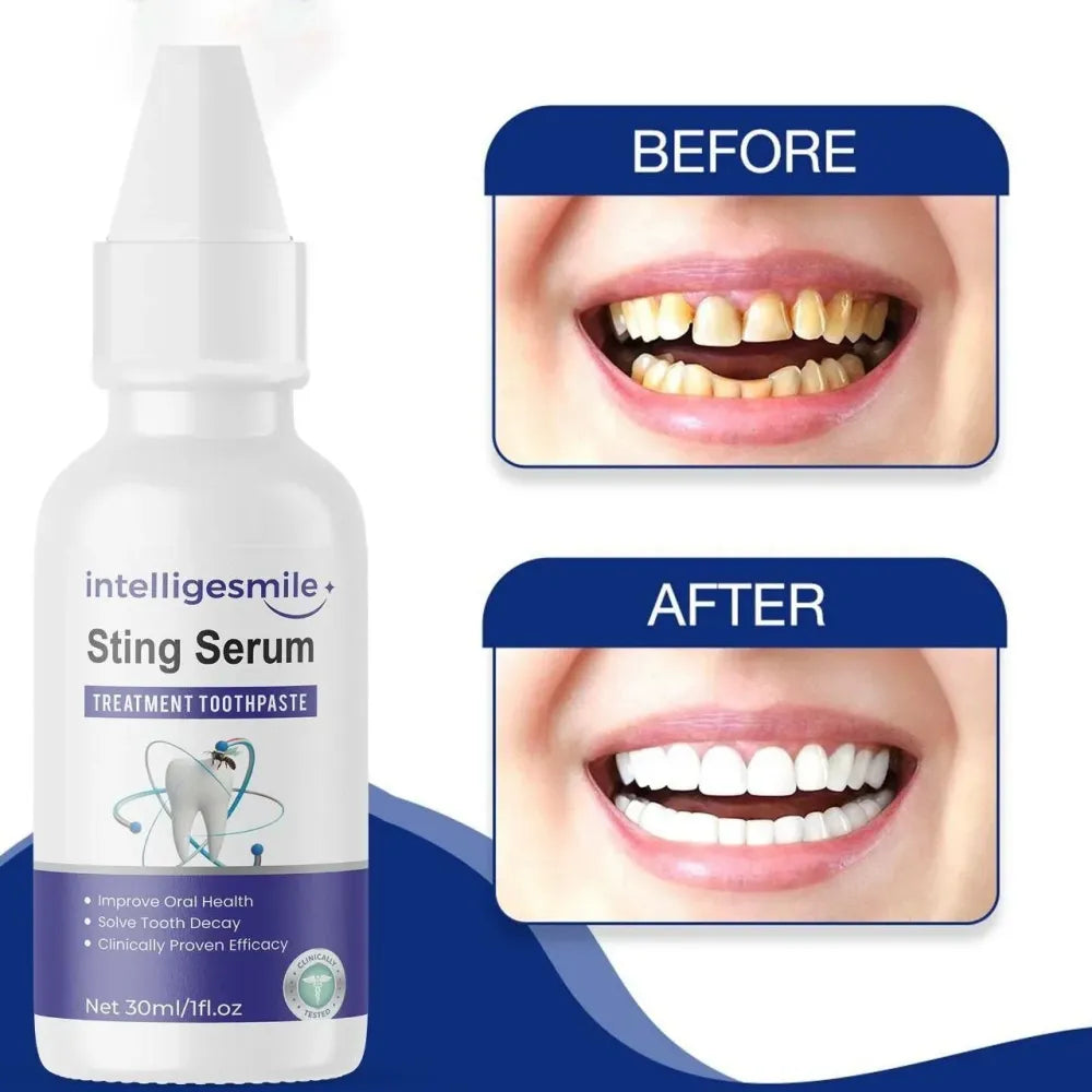 Intelligesmile sting serum toothpaste