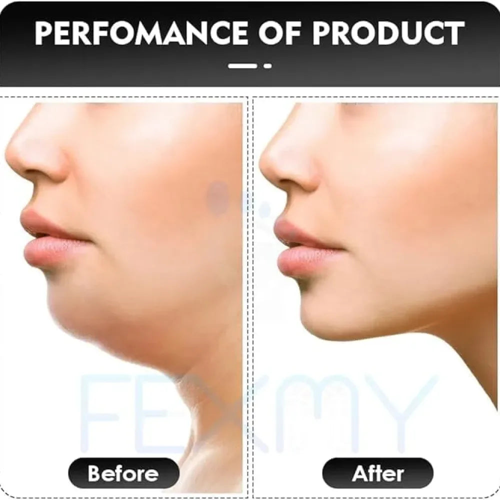 Jawline shaper trainer