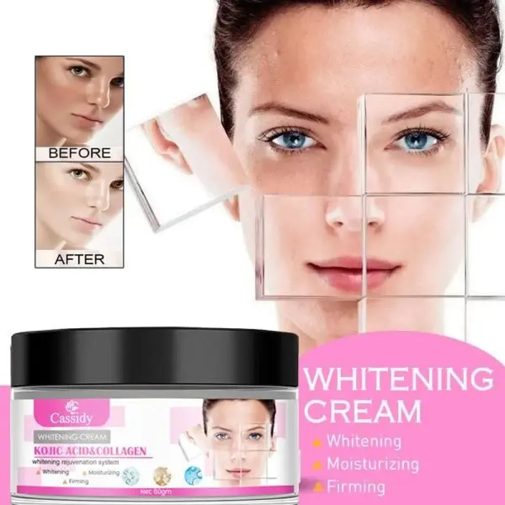 Cassidy kojic acid & collagen brightening cream 60g | moisturizer for dark spots even tone
