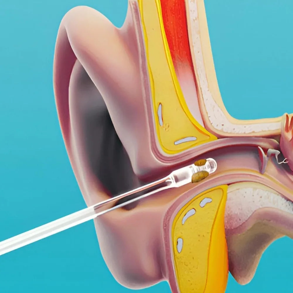 Reusable silicone ear cleaner - health care