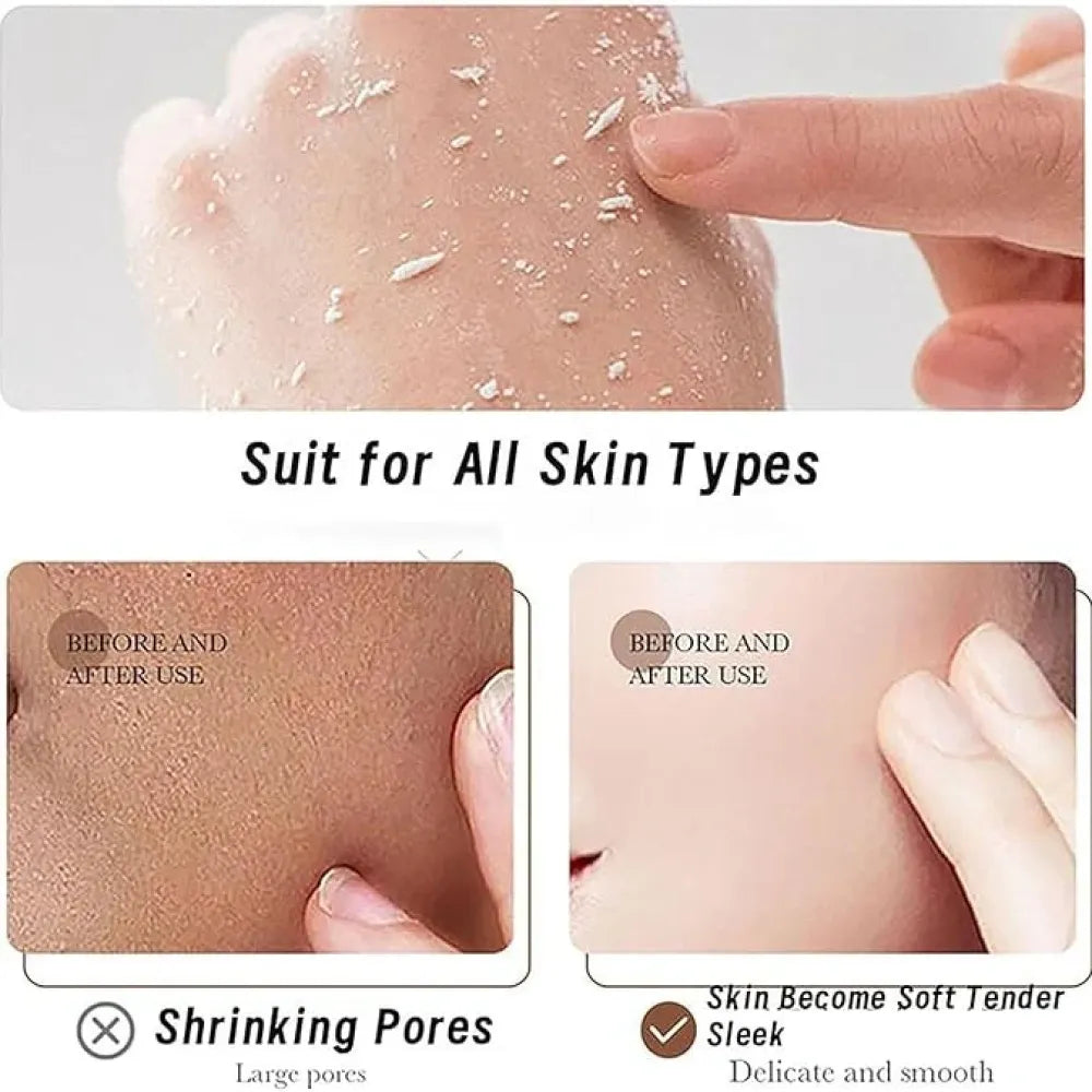 Rice tan remover gel