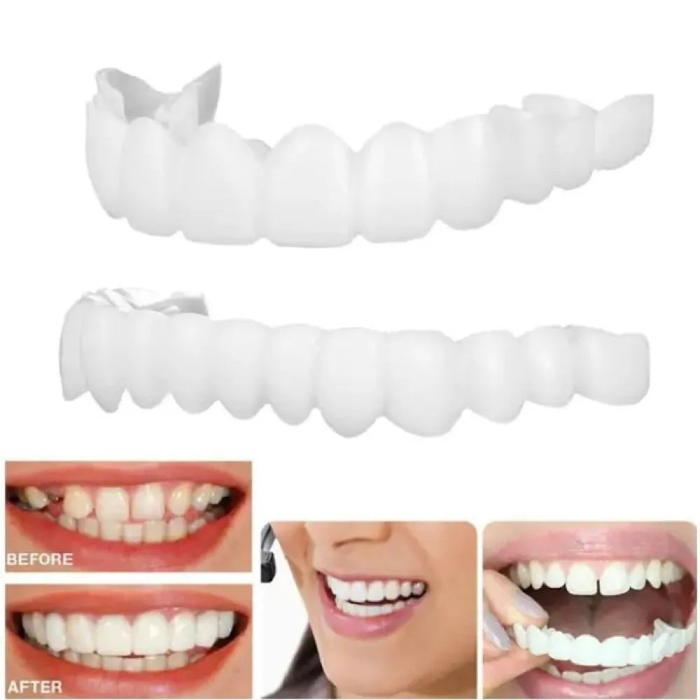 Teeth brace temporary braces cover
