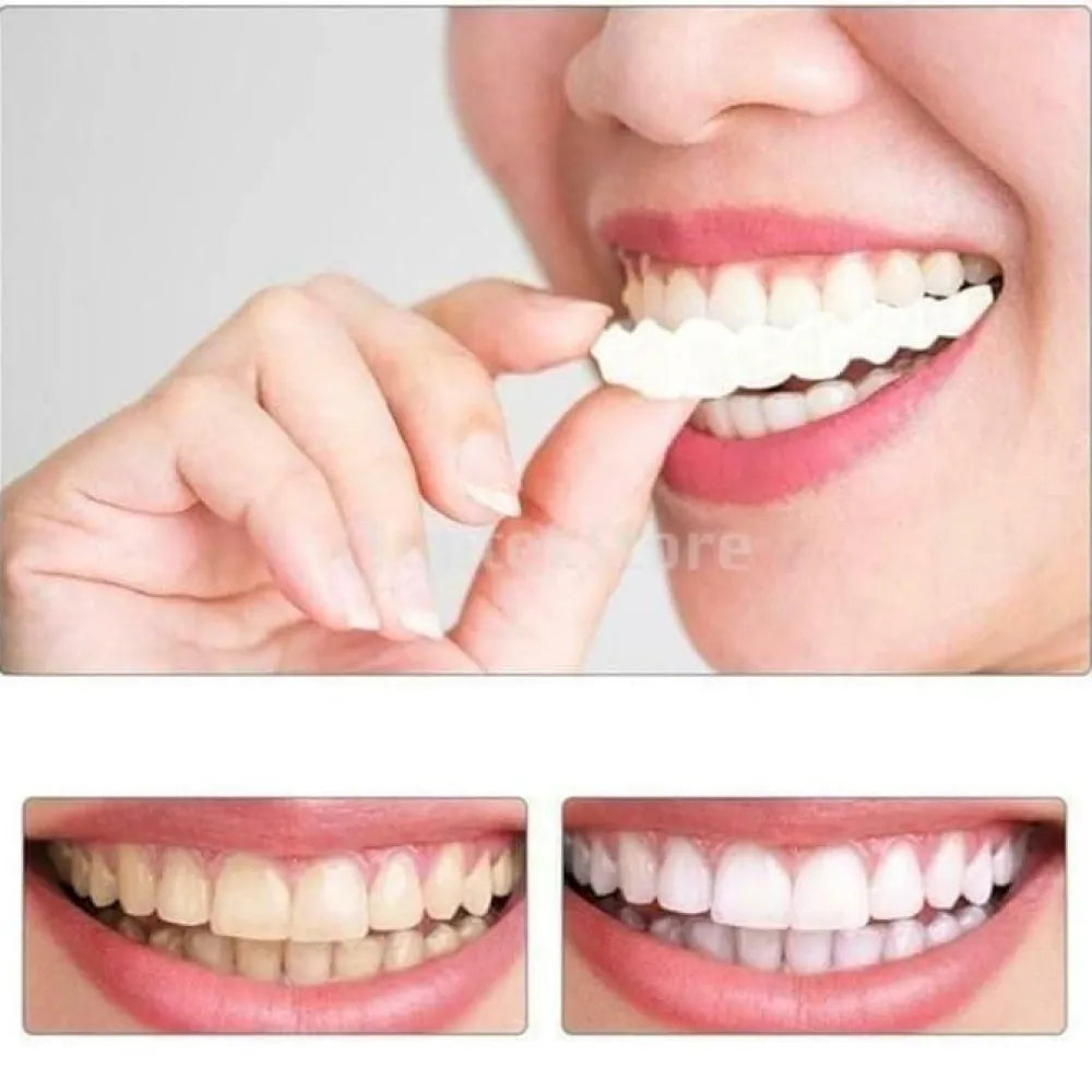 Teeth brace temporary braces cover