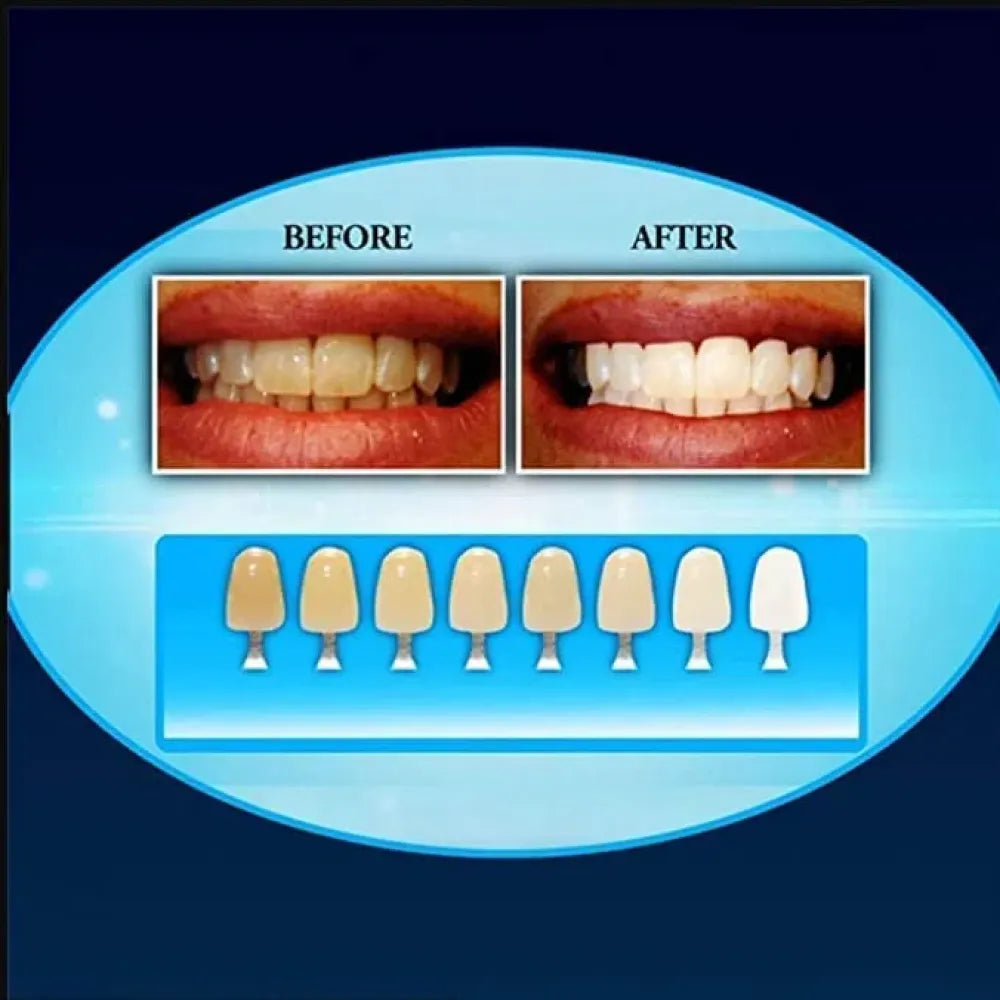 Teeth cleaning & whitening kit