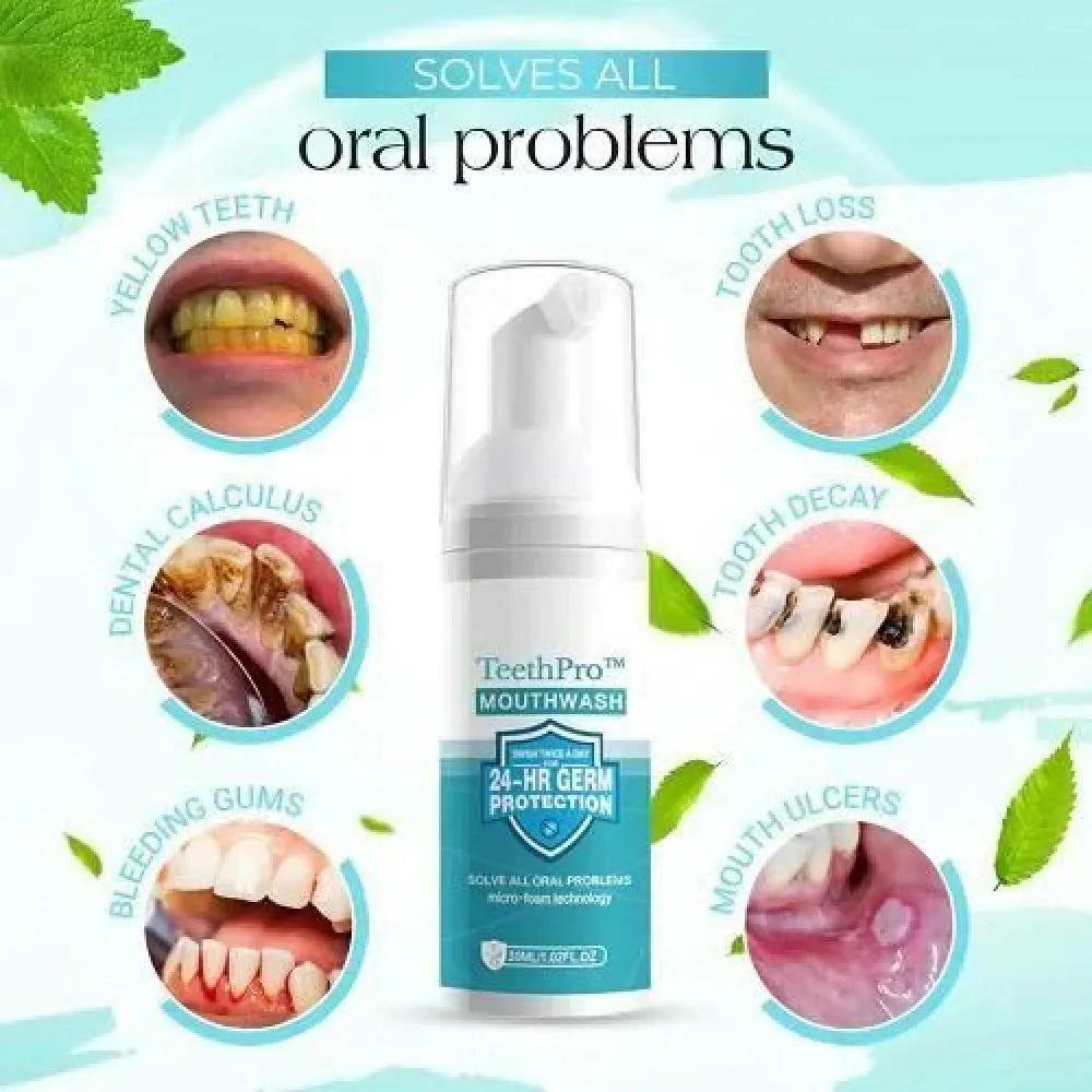 Teeth whitening foam 60ml (pack of 2)