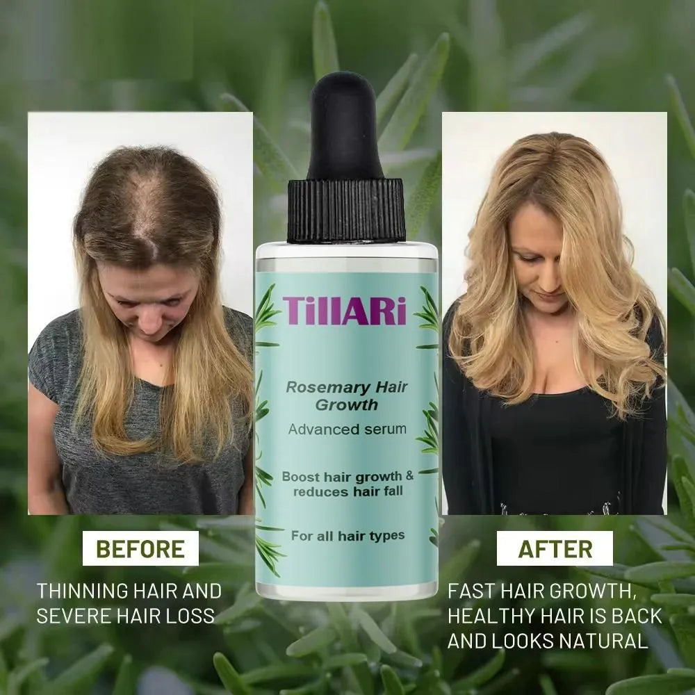 Tillari rosemary hair growth serum (pack of 2)