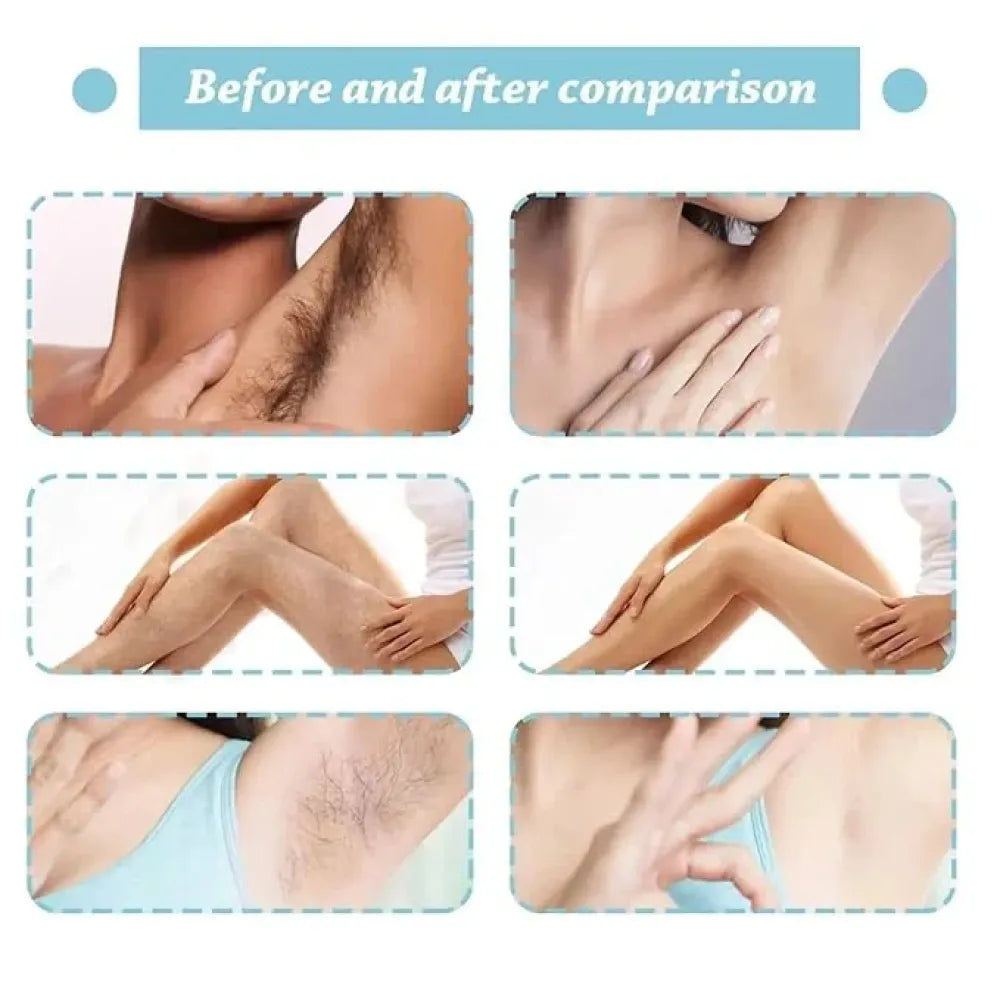Zidella hair removal spray 100ml
