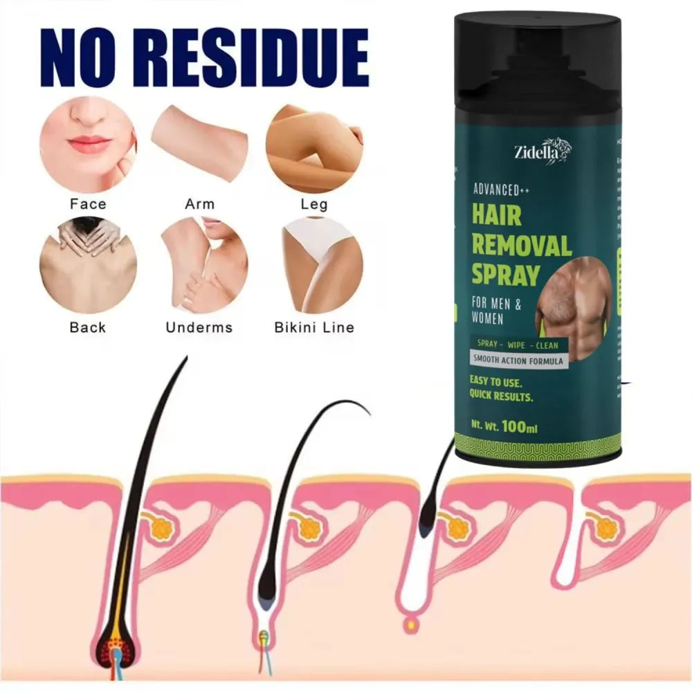 Zidella hair removal spray 100ml