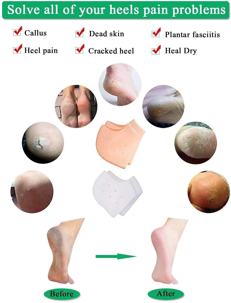 Heel pain relief socks