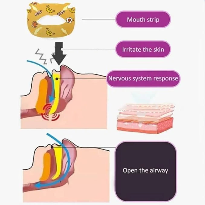 Comfort anti-snore stickers