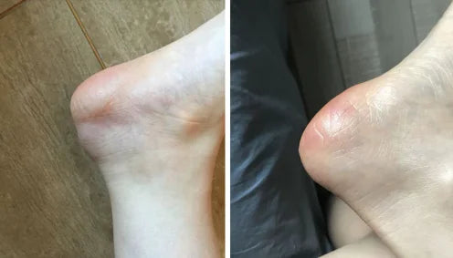 Shark collagen skin spray