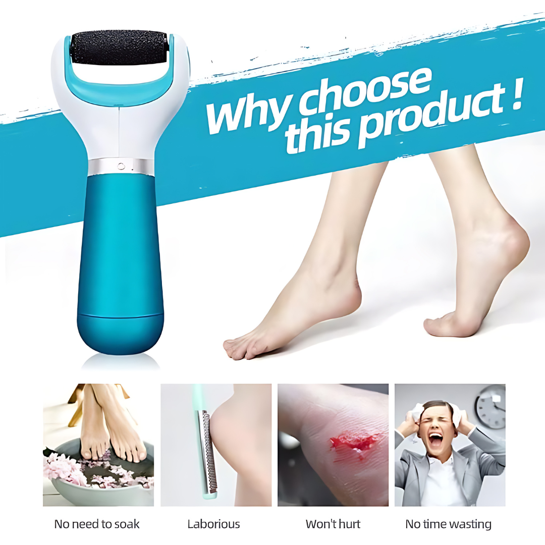 Foot Roller Callus Remover