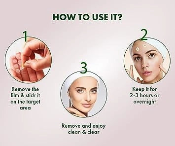 Acne pimple patch (72 pieces)