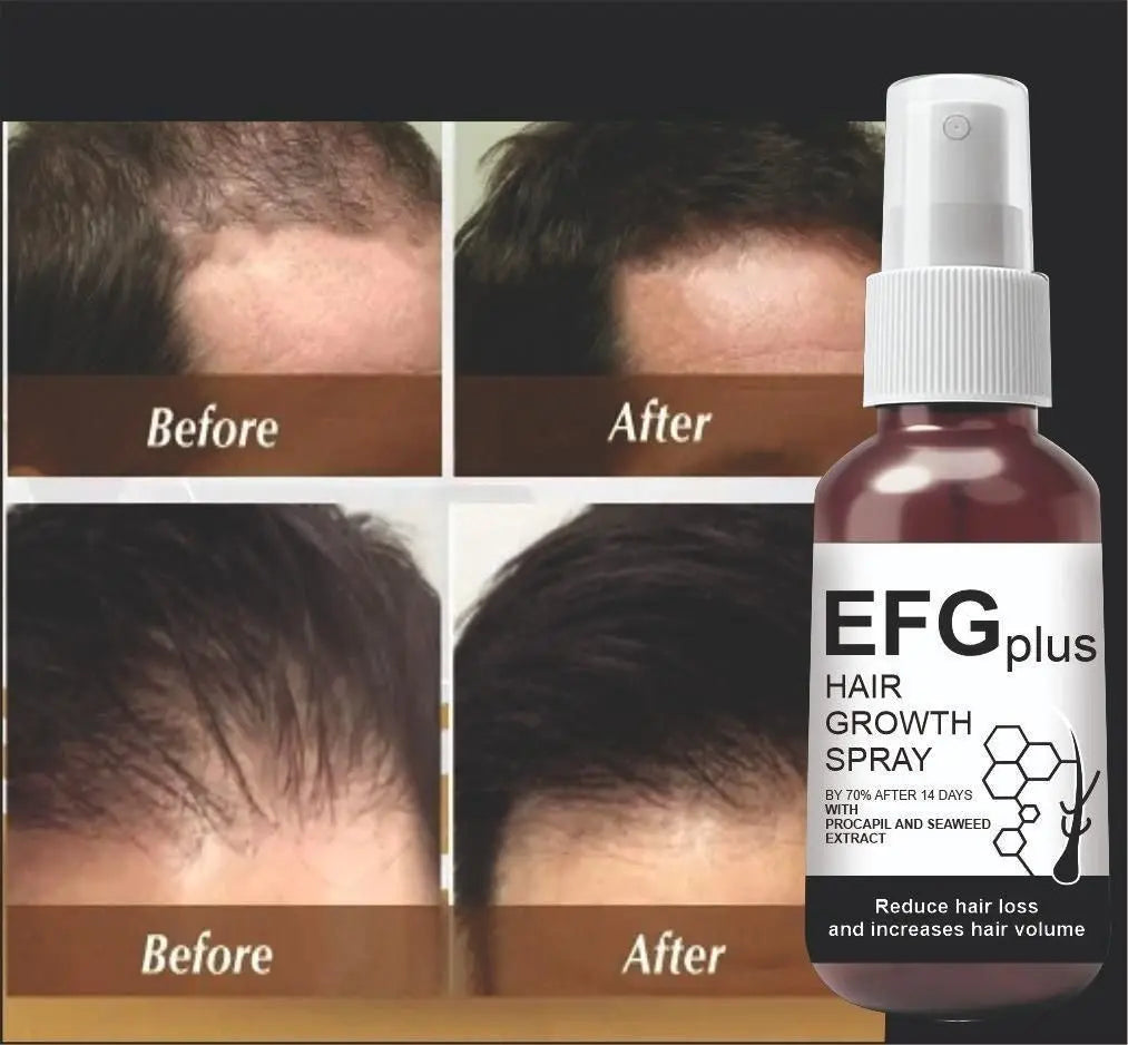 Efgplus hair growth spray – 50ml (pack of 2)