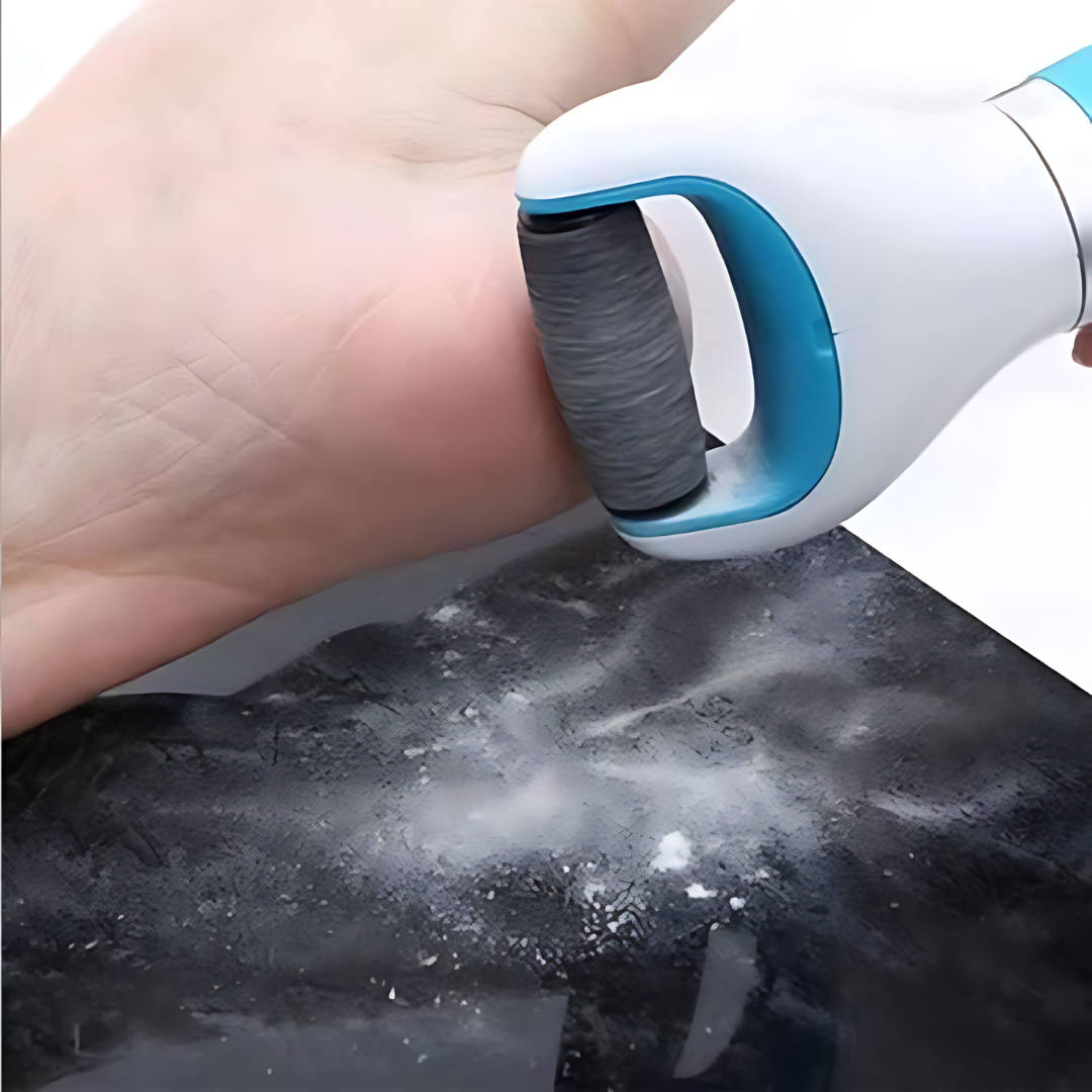 Foot Roller Callus Remover