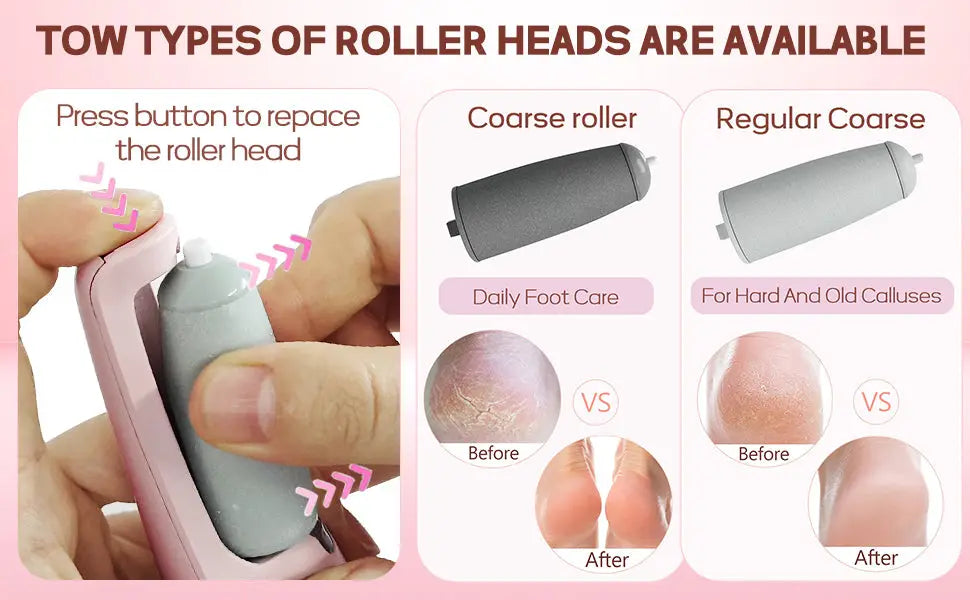 Electric callus remover tool